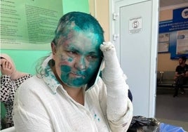 La guerra de Ucrania pone de nuevo a prueba a la prensa sin domesticar